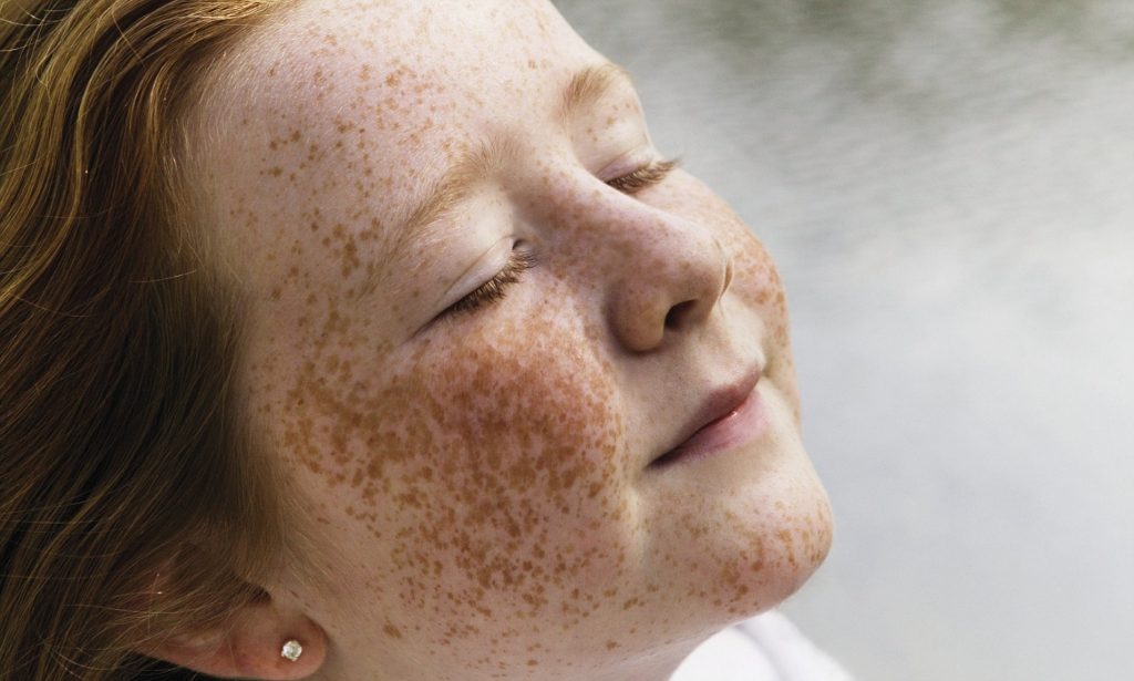 No One Is Born With Freckles