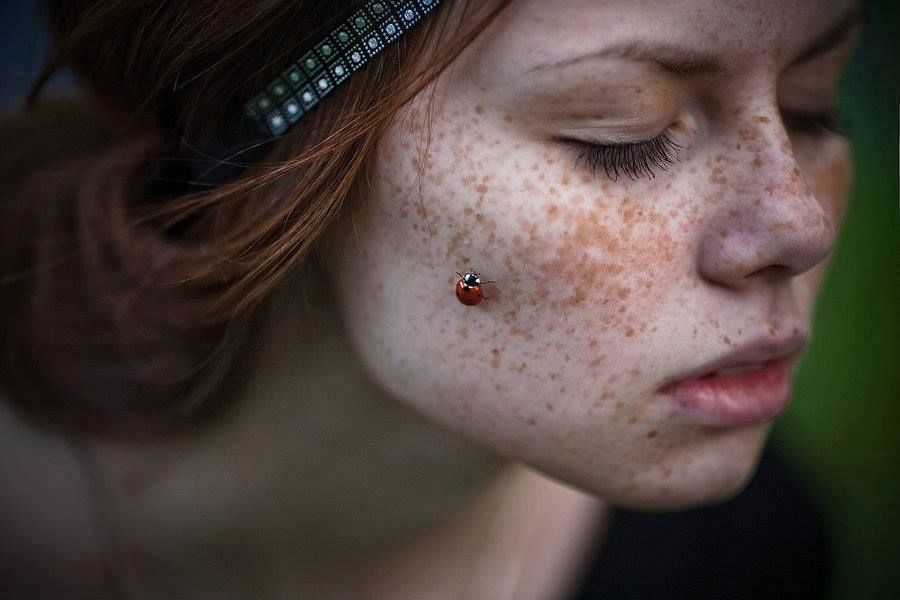 Freckles Were The Devil’s Mark In Middle Ages