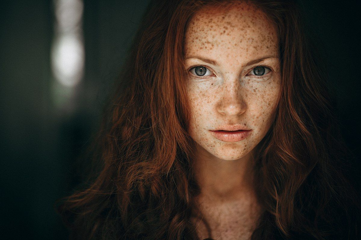 Not All Redheads Get Freckles