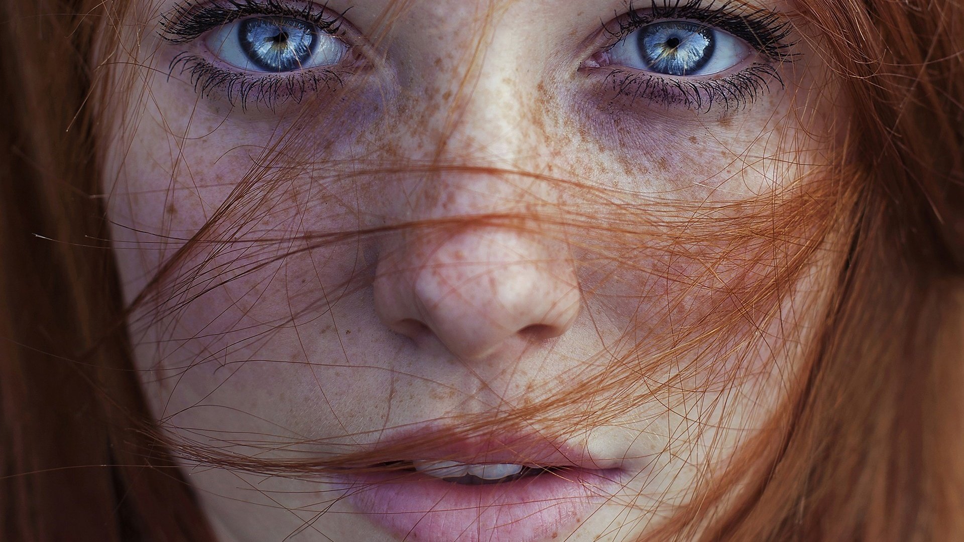 What Causes Freckles